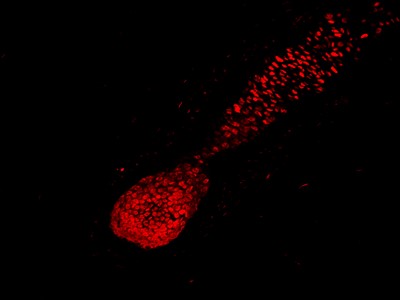 欧宝体育首页
介紹如何保護生物切片標本